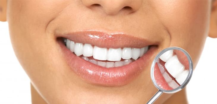 3 raisons pour être prudent avec les blanchisseurs de dents
